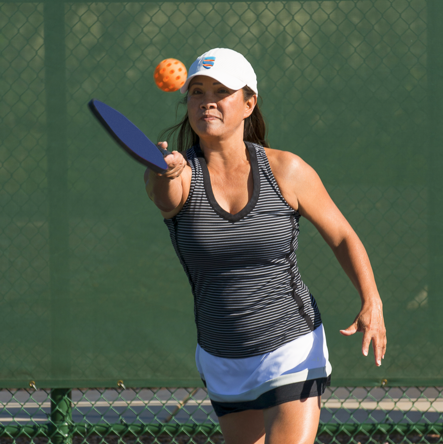 Understanding Pickleball Elbow: Symptoms, Causes, and Treatment